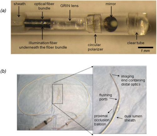 血管内部激光成像技术 实现心脏病发作预测的元件与器件研发